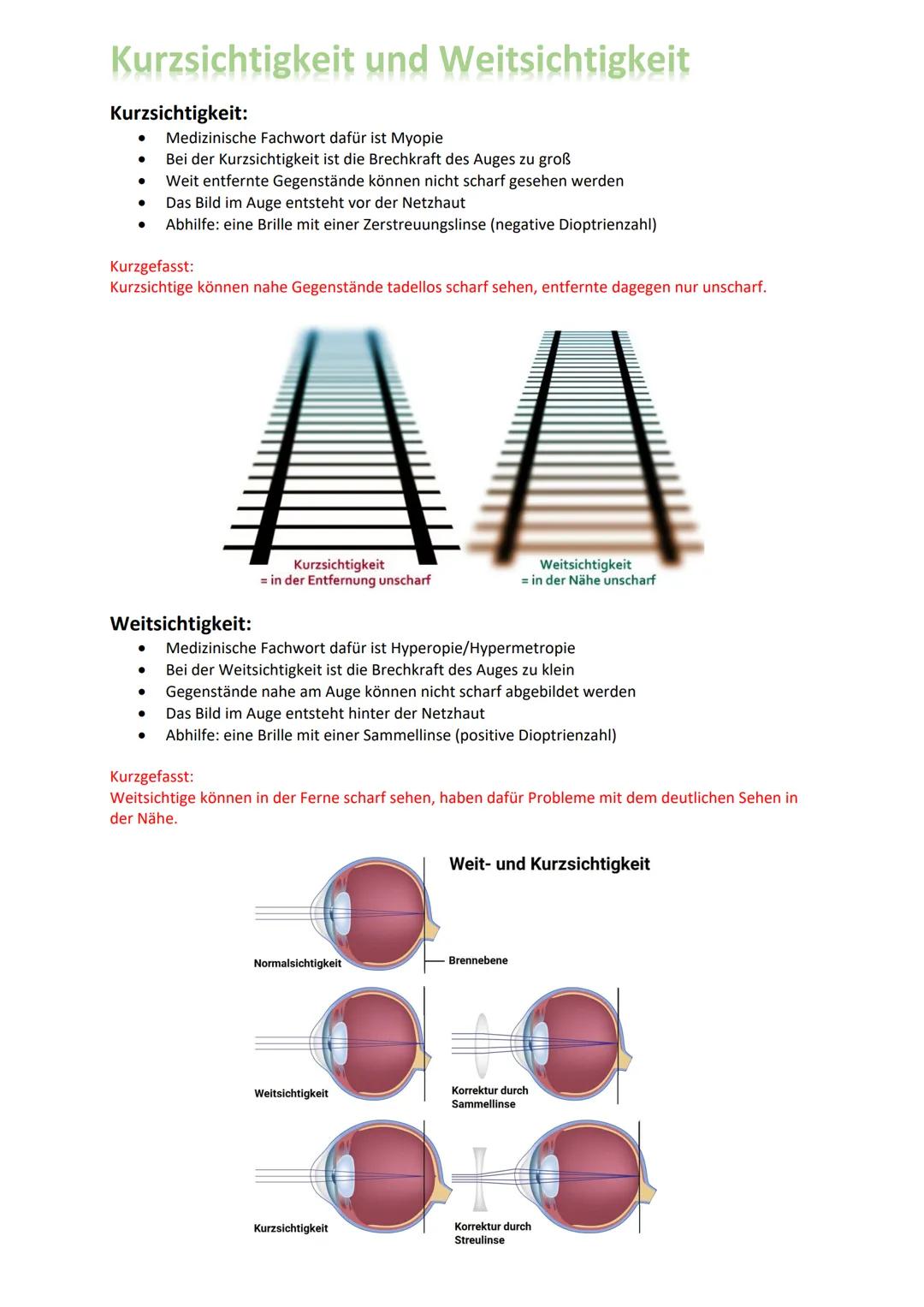 # Kurzsichtigkeit und Weitsichtigkeit

Kurzsichtigkeit:
- Medizinische Fachwort dafür ist Myopie
- Bei der Kurzsichtigkeit ist die Brechkraf