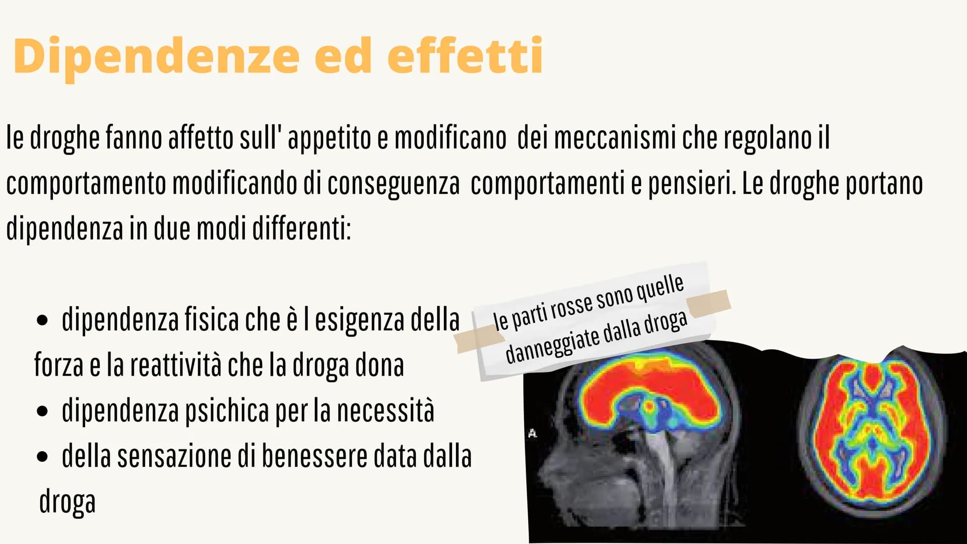 
<p>Le droghe e il loro effetto sul sistema nervoso influenzano sia il nostro corpo che la nostra mente. Le droghe sono sostanze psicoattive