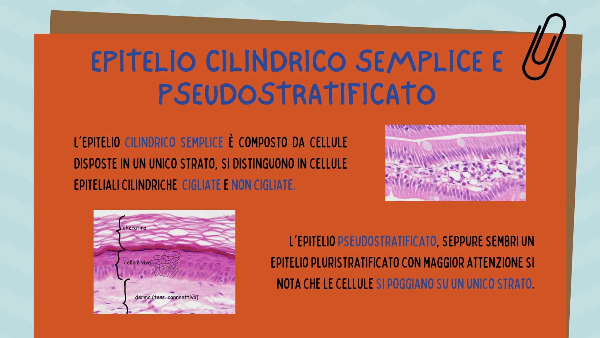 TESSUTO
EPITELIALE
OUT CHE COS'È?
IL TESSUTO EPITELIALE È UNO DEI QUATTRO TIPI FONDAMENTALI DI
TESSUTO CHE COMPONGONO IL NOSTRO CORPO E QUEL