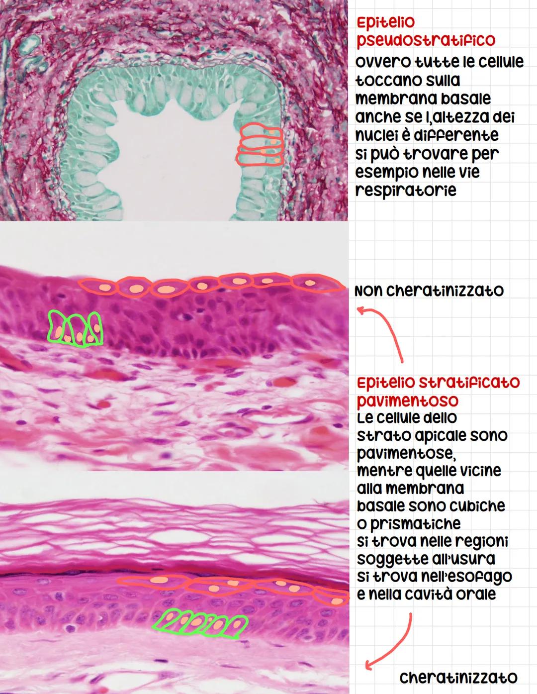 CALLE PROTOD
Epitelio
pseudostratifico
Ovvero tutte le cellule
toccano sulla
membrana basale
anche se l,altezza dei
nuclei è differente
si p