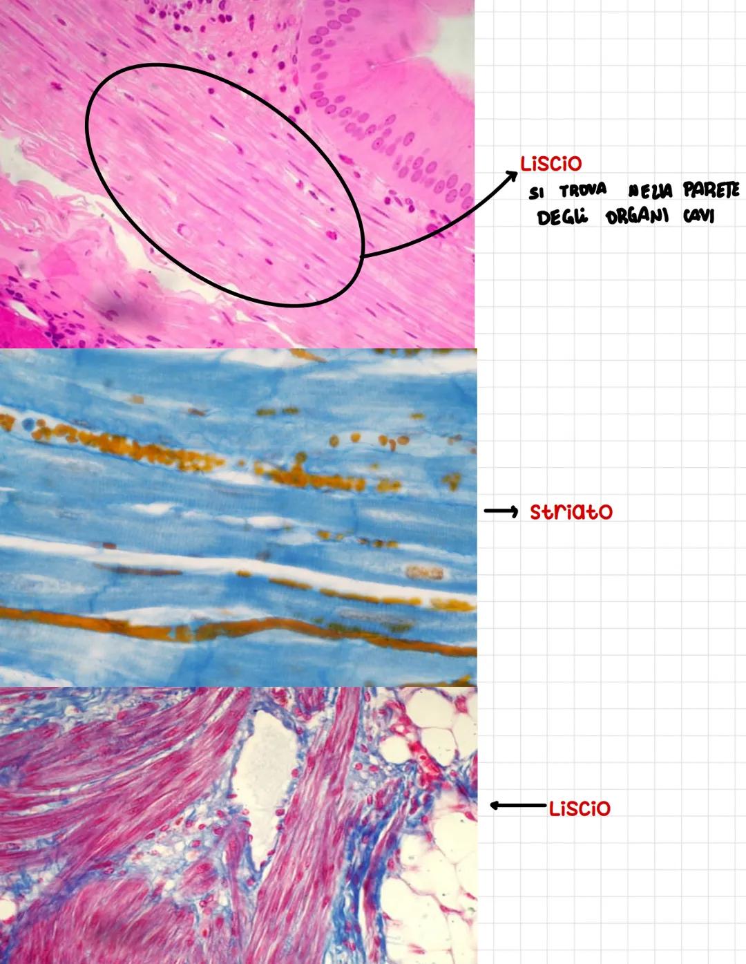 CALLE PROTOD
Epitelio
pseudostratifico
Ovvero tutte le cellule
toccano sulla
membrana basale
anche se l,altezza dei
nuclei è differente
si p
