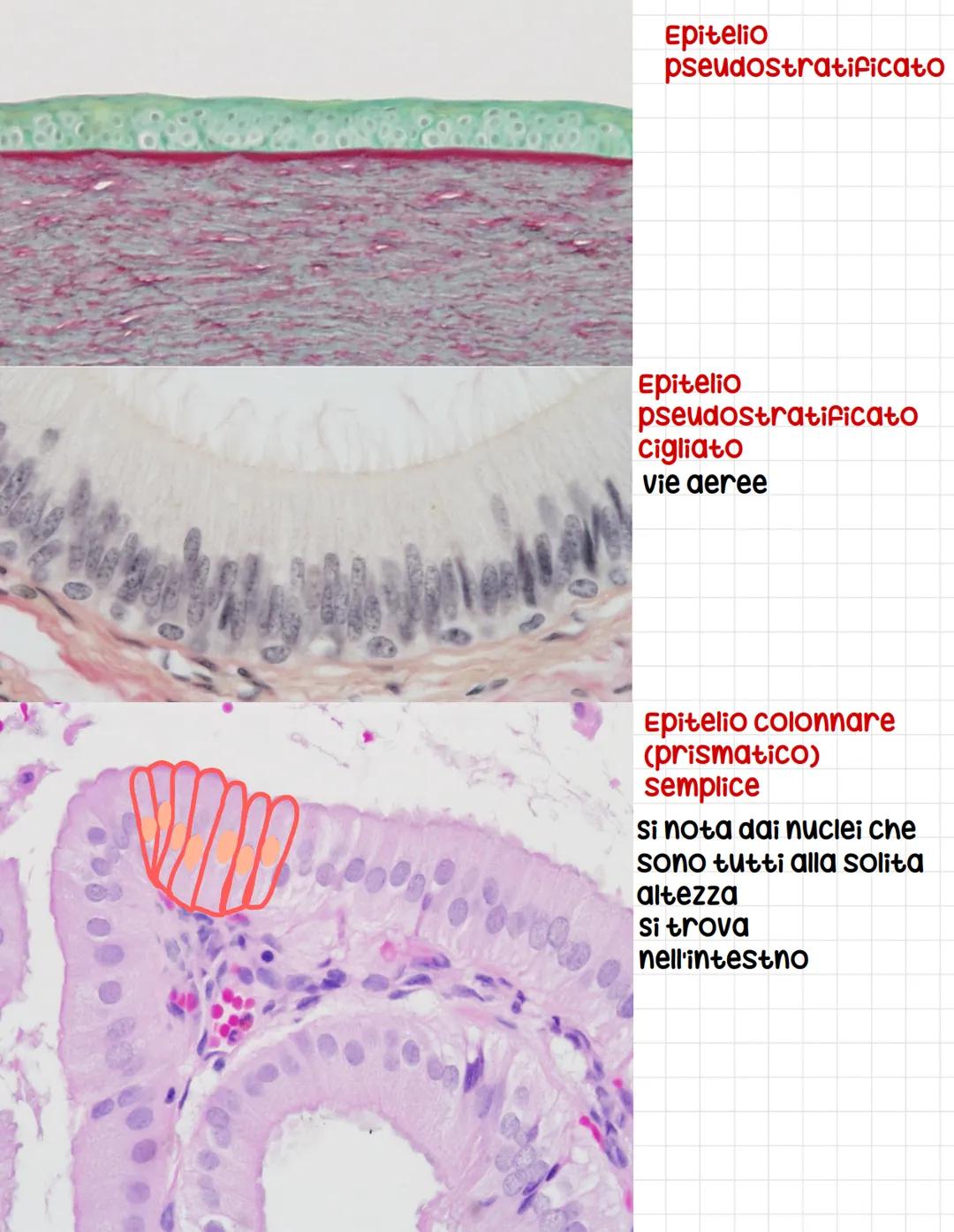 CALLE PROTOD
Epitelio
pseudostratifico
Ovvero tutte le cellule
toccano sulla
membrana basale
anche se l,altezza dei
nuclei è differente
si p