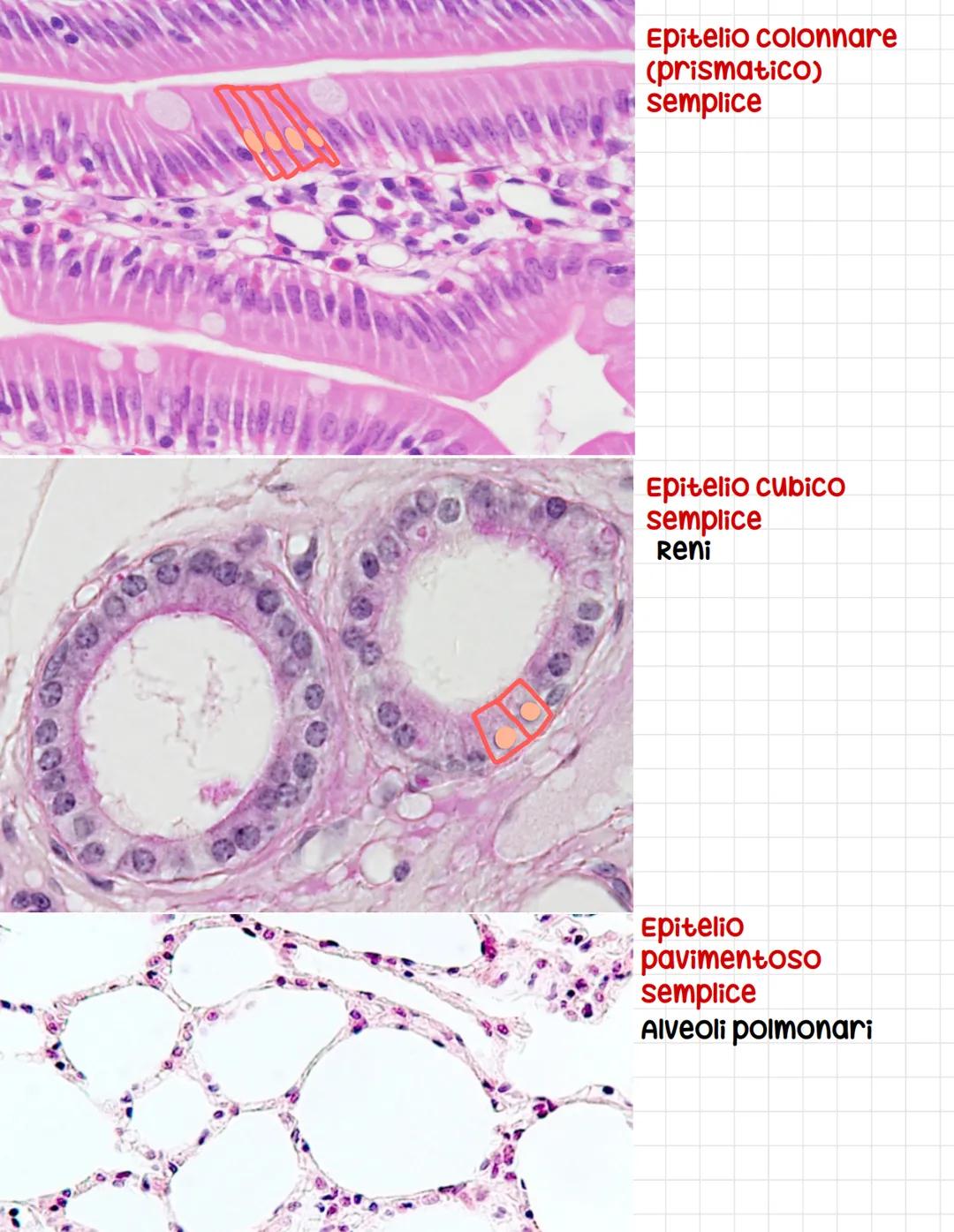 CALLE PROTOD
Epitelio
pseudostratifico
Ovvero tutte le cellule
toccano sulla
membrana basale
anche se l,altezza dei
nuclei è differente
si p