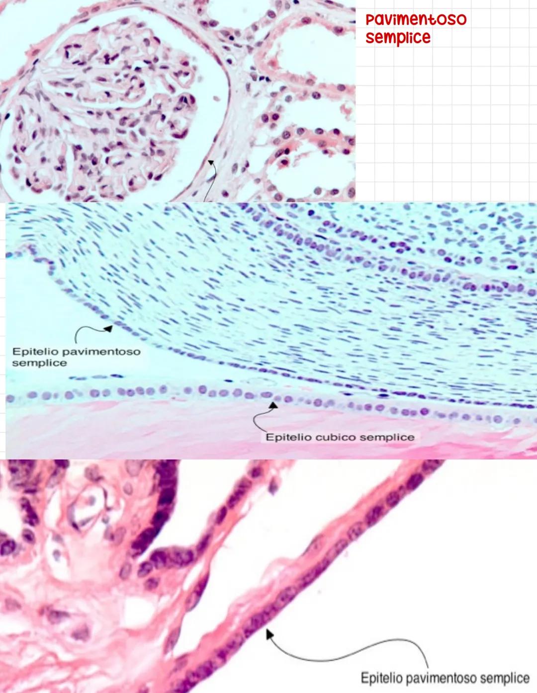 CALLE PROTOD
Epitelio
pseudostratifico
Ovvero tutte le cellule
toccano sulla
membrana basale
anche se l,altezza dei
nuclei è differente
si p