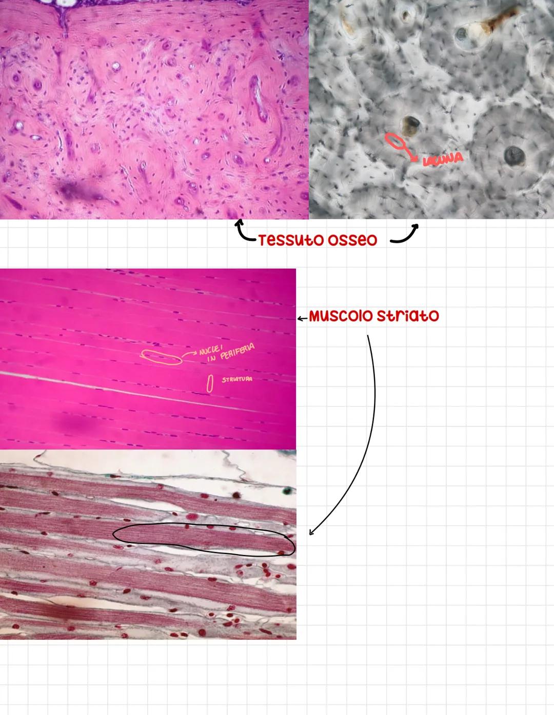 CALLE PROTOD
Epitelio
pseudostratifico
Ovvero tutte le cellule
toccano sulla
membrana basale
anche se l,altezza dei
nuclei è differente
si p
