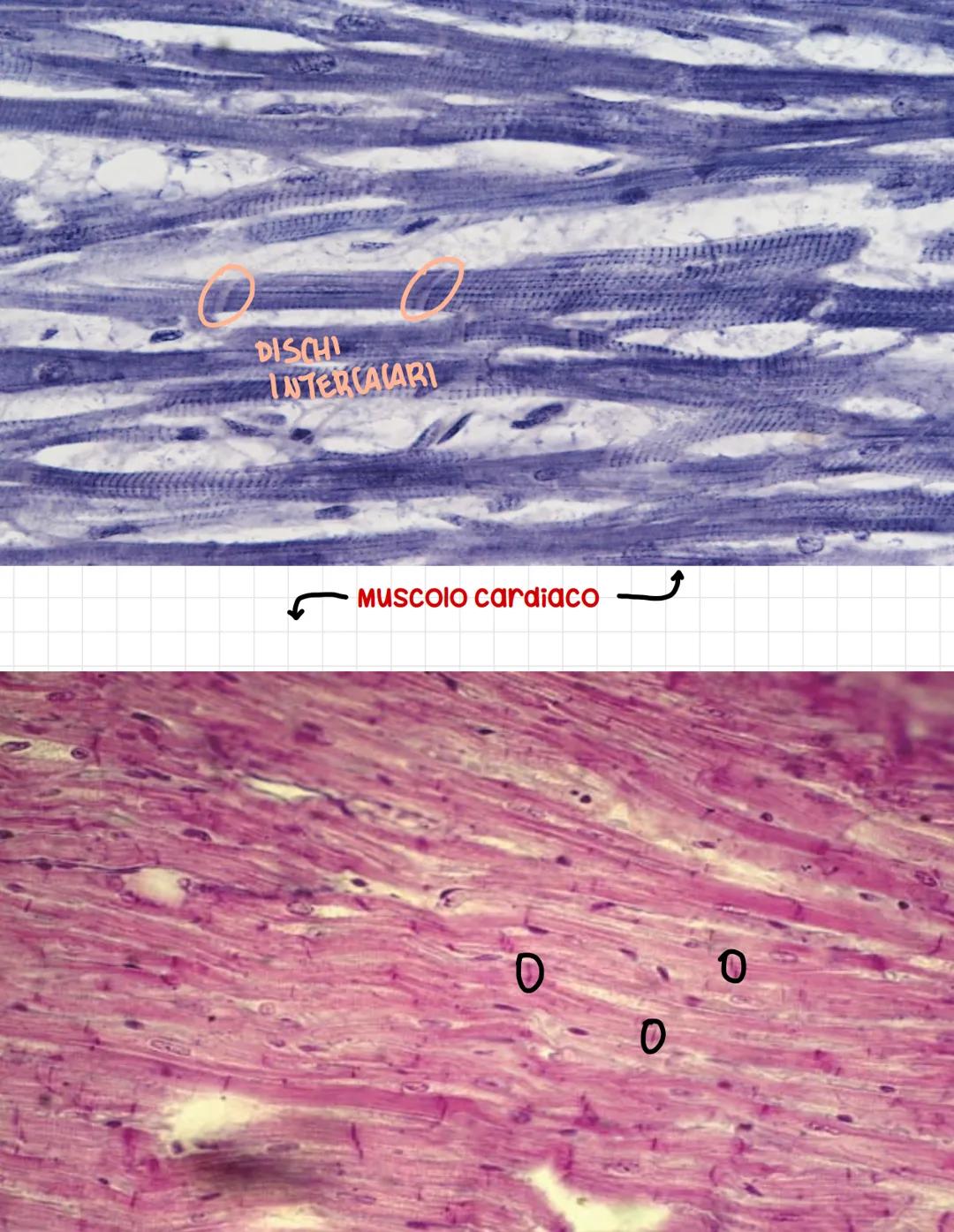 CALLE PROTOD
Epitelio
pseudostratifico
Ovvero tutte le cellule
toccano sulla
membrana basale
anche se l,altezza dei
nuclei è differente
si p